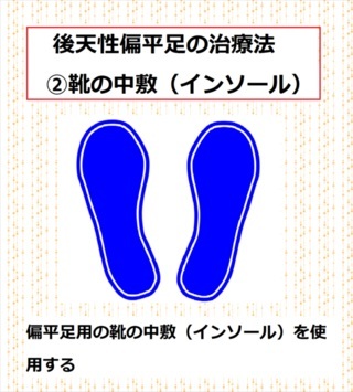 後天性偏平足　中敷　インソール　偏平足　土踏まず　内股の原因　ハイヒール・パンプスをキレイに履きこなそう！！ハイヒールとパンプスの違い、ハイヒール・パンプスの種類、選び方、足が痛くならない歩き方、ハイヒール・パンプスのお手入れの仕方、足のケアを紹介します！ハイヒール収納　パンプス収納　オーダー家具　下駄箱　オーダーメイド　靴箱　　シューズラック　シューズボックス