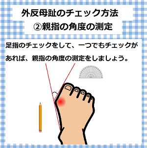 外反母趾のチェック法　親指の角度測定　足に合わない靴を履き続けると、体の様々な箇所に負担がかかり、足だけでなく、目、首、腰なども不調をきたします。足に合わない靴を履くことで起こる体の不調《靴擦れ、外反母趾、むくみ、偏平足、腰痛、猫背、肩こり、疲れ目》