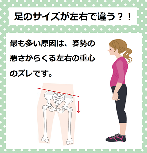 足のサイズが左右で違う　足に合わない靴を履き続けると、体の様々な箇所に負担がかかり、足だけでなく、目、首、腰なども不調をきたします。足に合わない靴を履くことで起こる体の不調《靴擦れ、外反母趾、むくみ、偏平足、腰痛、猫背、肩こり、疲れ目》